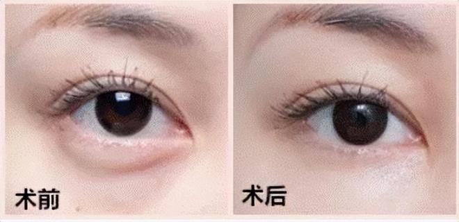 第1056页