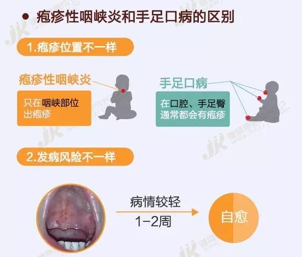 最新疱疹治疗方法，开启健康之门的密钥